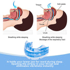Anti-snoring mouthpiece (Night Teeth)